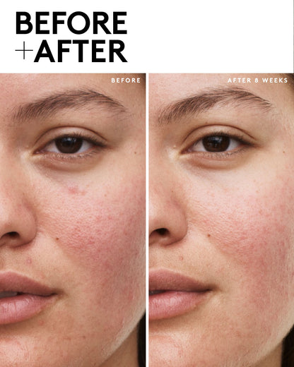 Fenty Skin Vault 5-Piece AM + PM Skincare Essentials with Mineral SPF