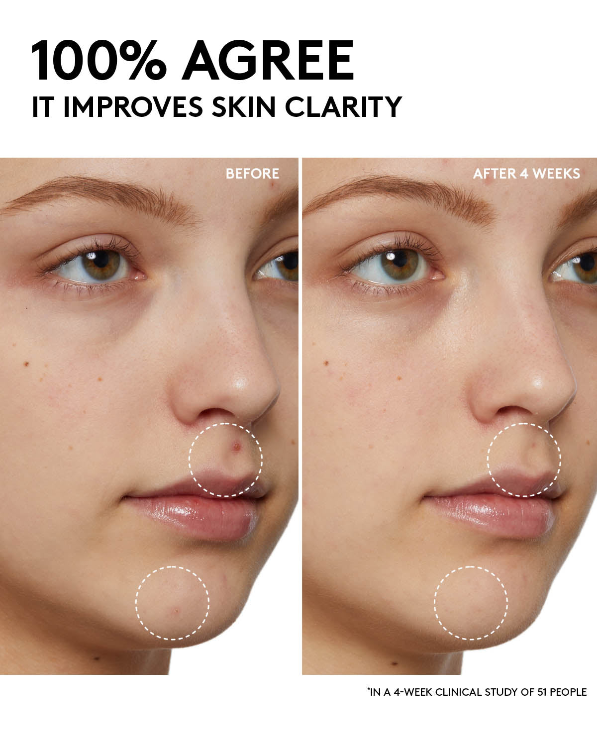 Fenty Skin Start¡¯rs Full-Size Bundle: Oily Skin Edition