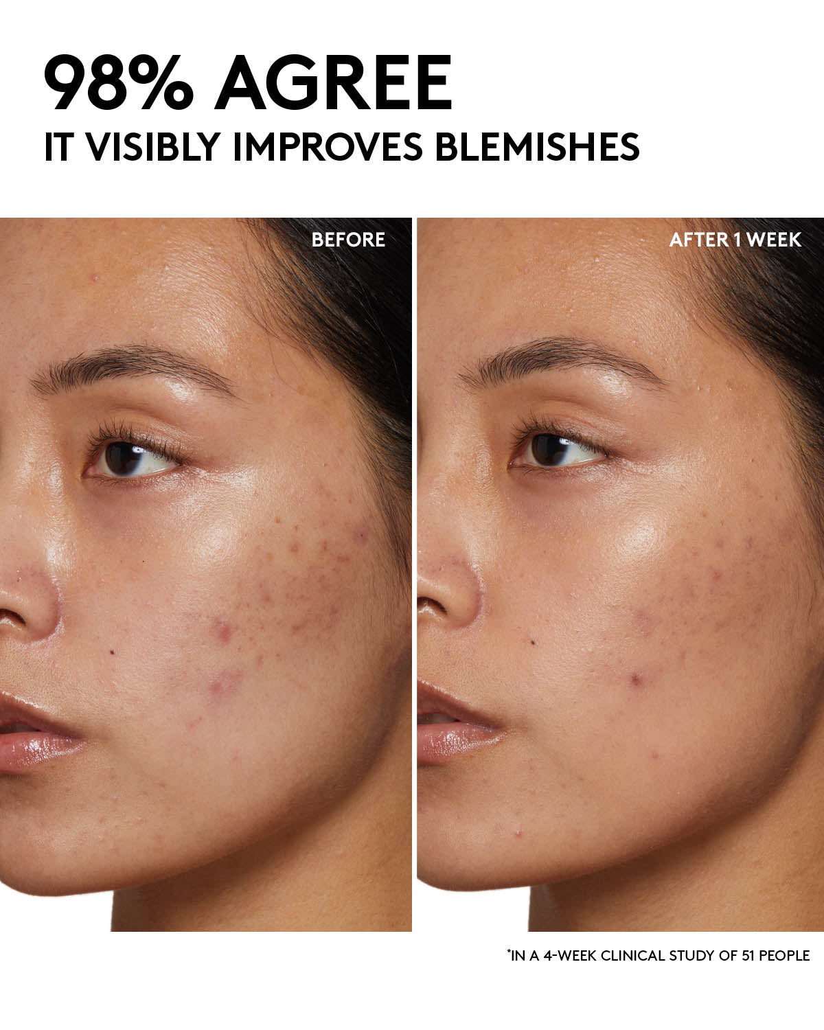 Fenty Skin Start¡¯rs Full-Size Bundle: Oily Skin Edition