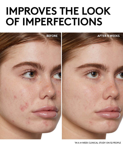 Fenty Skin Start¡¯rs Full-Size Bundle: Oily Skin Edition