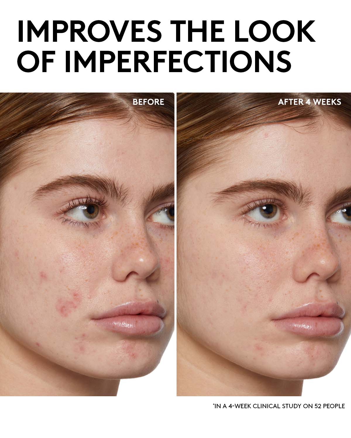 Fenty Skin Start¡¯rs Full-Size Bundle with Mineral SPF: Oily Skin Edition